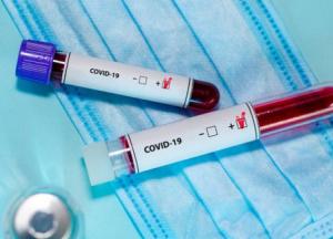 Новые случаи коронавируса в Украине: в Радомышле принимают чрезвычайные меры