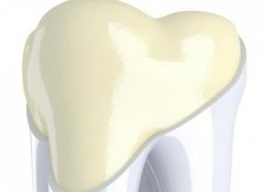 Ученые создали зубную эмаль, которая тверже и прочнее настоящей