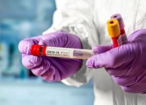 В Украине обнаружено уже более 66,5 тыс. случаев COVID-19, за сутки - 919