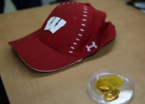 Изобретена кепка, которая может вылечить от облысения