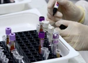 В Украине за сутки 846 новых COVID-случаев