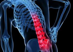 Ученые установили главную причину хронических болей в спине 