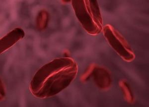 Медики назвали главные симптомы атеросклероза