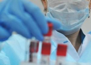 Число случаев COVID-19 в Украине превысило 110