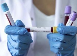 В Украине за сутки новый антирекорд - 4 753 случаев COVID-19