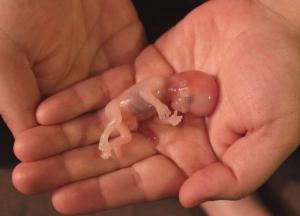 "Відмовитись від абортів навіть у приватних клініках": у рф готують росіянок до вічних пологів (відео)