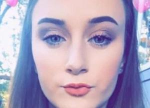 Девушка обожгла кожу и осталась лысой из-за краски (фото, видео) 