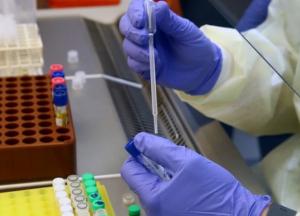 В Украине зафиксировано 9410 случаев COVID-19, из них 239 летальных