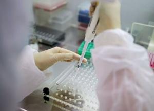 В Украине 8687 новых случаев коронавируса