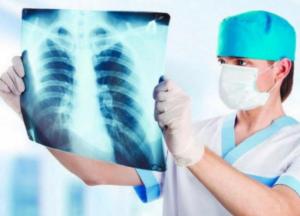 Медики назвали скрытые симптомы пневмонии