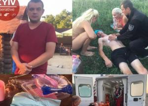 На озере под Киевом отдыхающего пырнули ножом: раненого спасали случайные свидетели