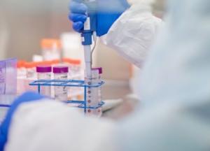 В Украине более 3200 новых заражений коронавирусом