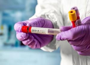 В Украине 749 новых случаев коронавируса