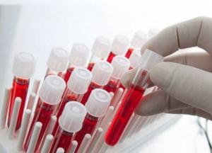 Люди с какой группой крови меньше всего подвержены раку