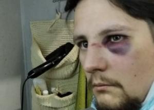 Во Львове на двух ветеранов АТО напали полицейские