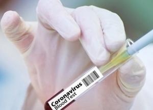 Штамм Дельта в Украине составляет 100% анализов