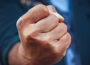 В Одессе двое мужчин избили кассира из-за замечания о маске (фото)