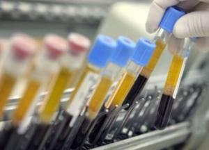 Ученые остановили рост рака и распространение метастаз