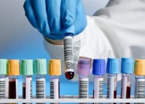 В Украине зафиксировано 3764 случая COVID-19, из них 108 летальных