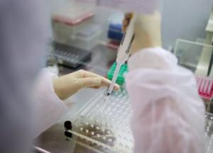 В Украине на следующей неделе планируют запустить массовое тестирование на антитела к COVID-19 (видео)