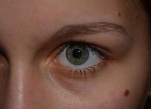 Онкологи объяснили, какой цвет родинок является опасным