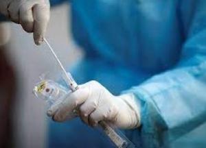 В Украине 6911 новых случаев коронавируса