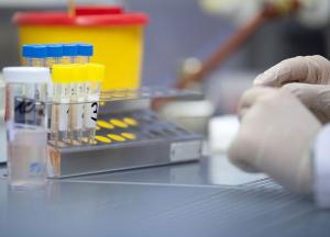 В украинских аптеках появятся тесты на коронавирус: сколько они будут стоить