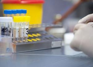 В Украине уже 54 тыс. случаев COVID-19, за сутки - 612