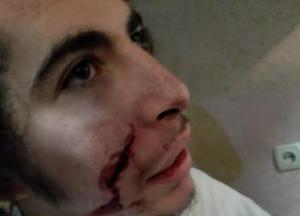 В Умани напали с ножом на хасида