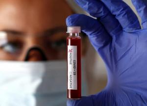 Врач назвала совершенно новые симптомы коронавируса