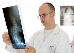 Нарушение осанки — распространенная проблема