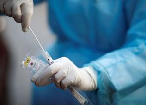 В Украине 8 416 новых случаев коронавируса, выздоровели почти вдвое больше