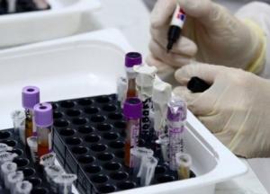 Рост случаев: в Украине 726 новых заражений коронавирусом