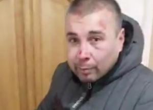 В Харькове избили директора парка «Юность» (видео)