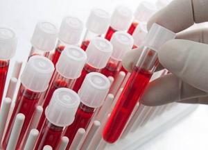 Ученые выяснили, какие болезни характерны для каждой группы крови 