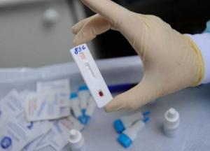 Число запросов о покупке теста на ВИЧ увеличилось в десятки раз после документального фильма Дудя