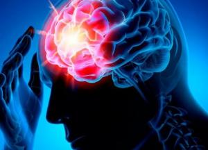 Врачи рассказали, как уберечься от инсульта