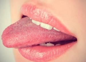 Медики назвали симптомы рака языка 