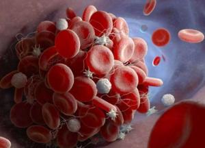 Ученые перечислили признаки, указывающие на риск тромбоза после вакцинации