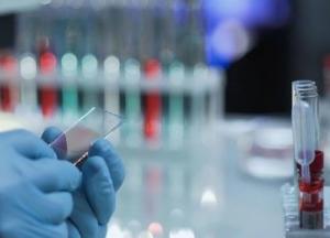 На Тернопольщине женщину пять дней не тестировали: она умерла от COVID-19