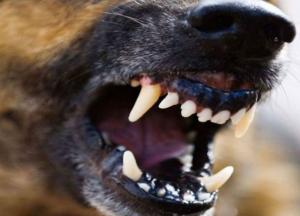 В Одессе ротвейлер чуть не загрыз хозяйку (видео)