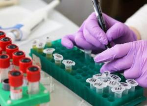 Какие анализы следует обязательно сдавать дважды в год: советы врача