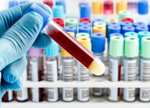 Ученые "вычислили" самую проблемную группу крови