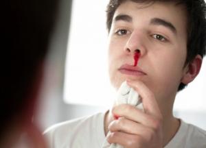 Медики объяснили, как быстро остановить кровотечение из носа