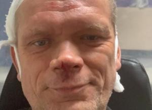 Экс-министра аграрной политики избили двое неизвестных с битами