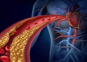 Названы простые способы снизить уровень холестерина