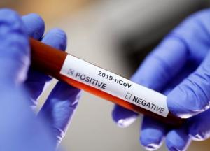 В Киеве зафиксированы первые случаи заражения коронавирусом