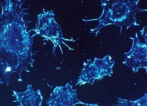 Названы виды онкологии, которые передаются по наследству