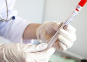 В Украине уже 265 тыс. случаев COVID-19, за сутки - 4 420