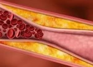 Названы продукты, которые помогут укрепить сосуды и снизить холестерин